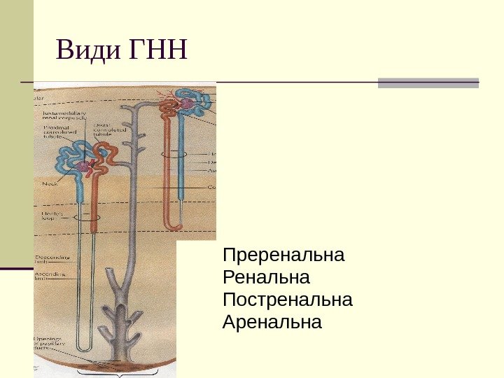   Види ГНН Преренальна Ренальна Постренальна Аренальна 